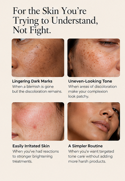 Who MYCO-LUMEN is for: lingering dark marks, uneven-looking tone, easily irritated skin, simpler routine